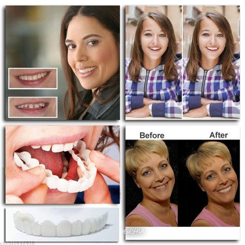 Teeth Denture (PACK OF 2)